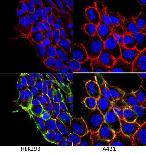 Anti-integrin β1 Antibody, Clone P5d2 